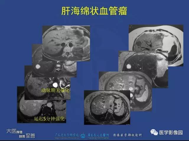【PPT】对比剂安全与规范使用