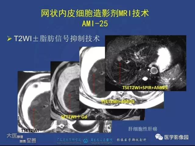 【PPT】对比剂安全与规范使用