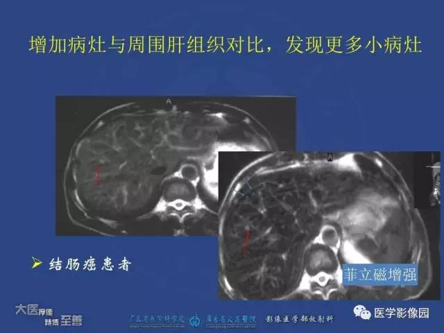 【PPT】对比剂安全与规范使用