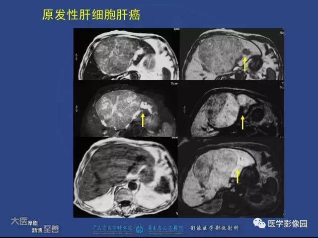 【PPT】对比剂安全与规范使用