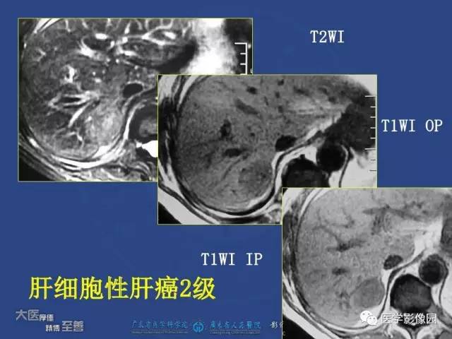【PPT】对比剂安全与规范使用
