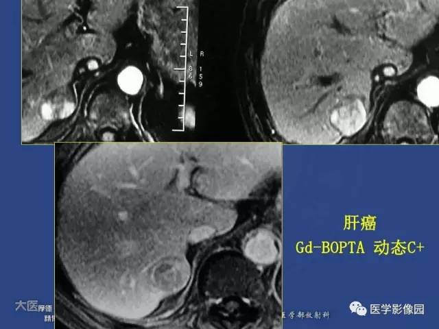 【PPT】对比剂安全与规范使用