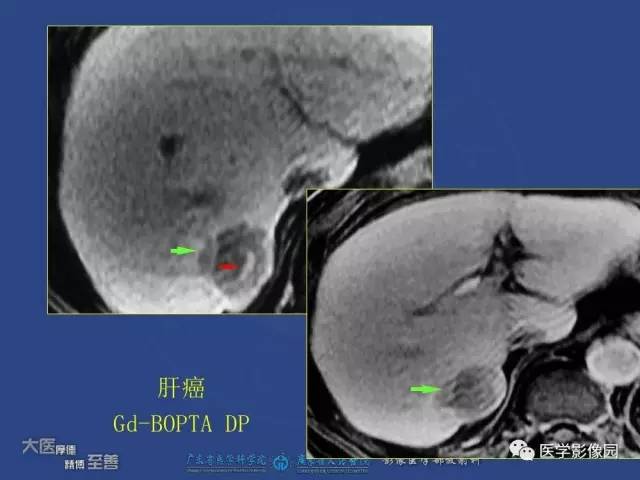 【PPT】对比剂安全与规范使用