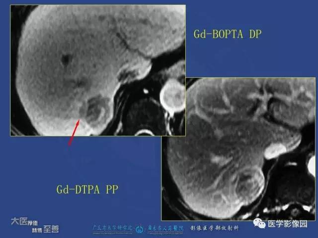【PPT】对比剂安全与规范使用