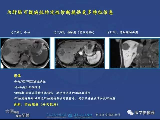 【PPT】对比剂安全与规范使用