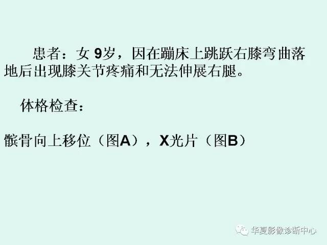 【病例】髌骨袖状撕脱骨折1例X线影像表现