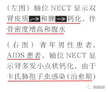 “肾皮/髓质钙质沉着症”的鉴别诊断