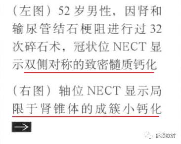 “肾皮/髓质钙质沉着症”的鉴别诊断