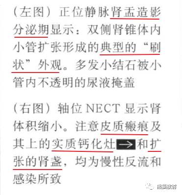 “肾皮/髓质钙质沉着症”的鉴别诊断