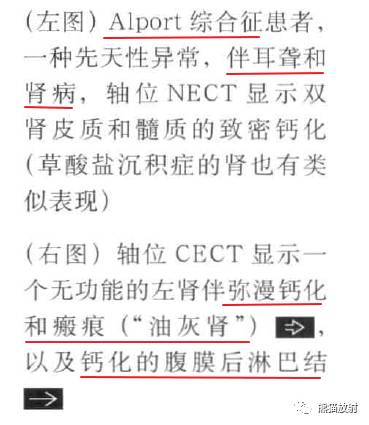 “肾皮/髓质钙质沉着症”的鉴别诊断