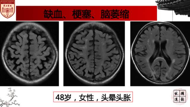 自动草稿