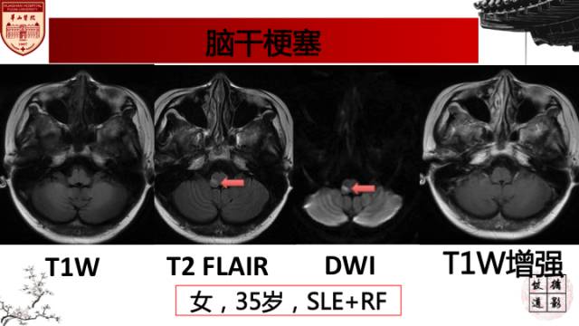 自动草稿