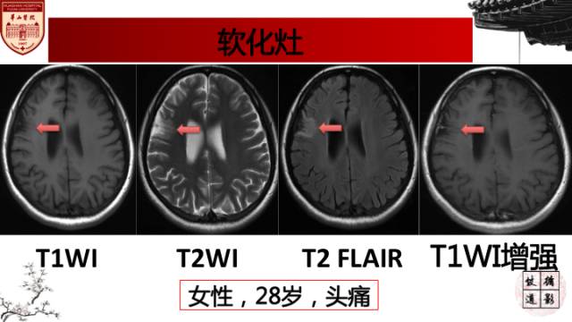 自动草稿