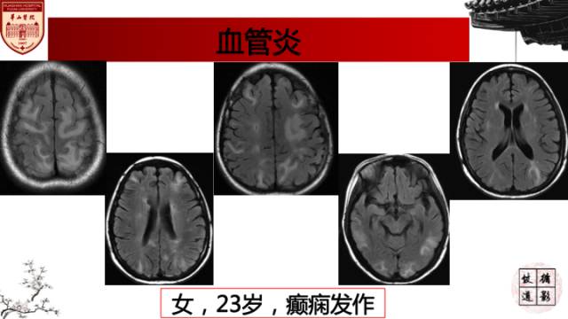 自动草稿
