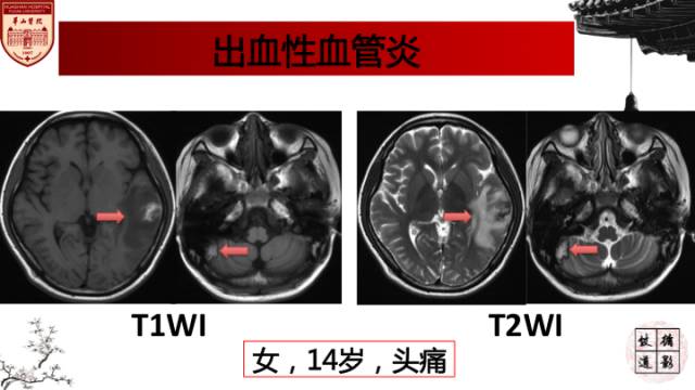 自动草稿
