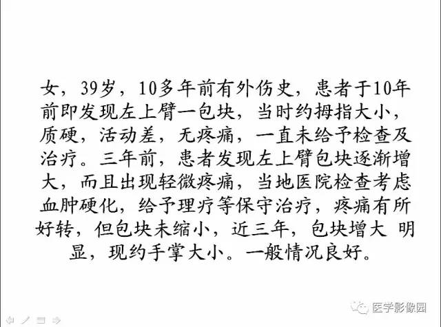 【病例】左上臂腹壁外韧带样纤维瘤1例CT及MR