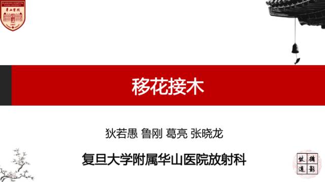 【病例】硬脑膜动静脉瘘1例MR影像表现分析 【病例】硬脑膜动静脉瘘1例MR影像表现分析