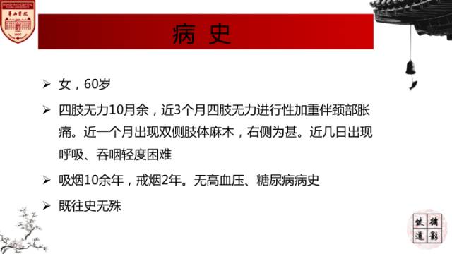 【病例】硬脑膜动静脉瘘1例MR影像表现分析