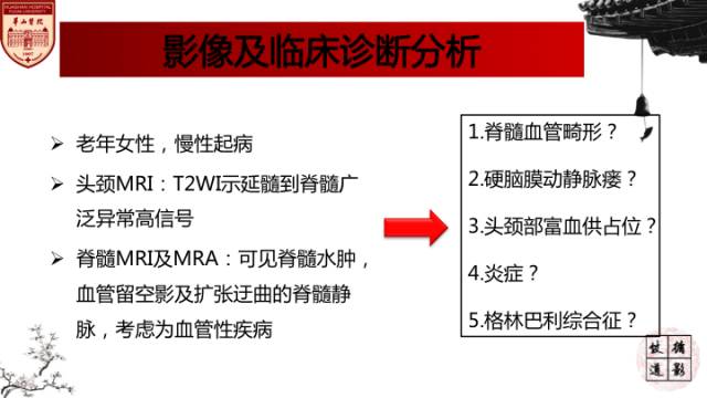 【病例】硬脑膜动静脉瘘1例MR影像表现分析 【病例】硬脑膜动静脉瘘1例MR影像表现分析