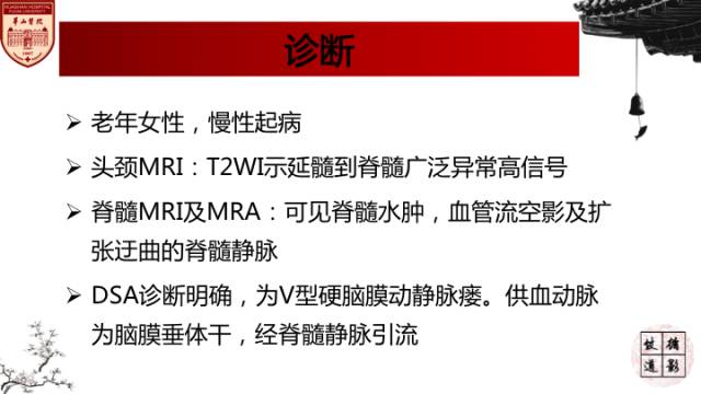 【病例】硬脑膜动静脉瘘1例MR影像表现分析 【病例】硬脑膜动静脉瘘1例MR影像表现分析