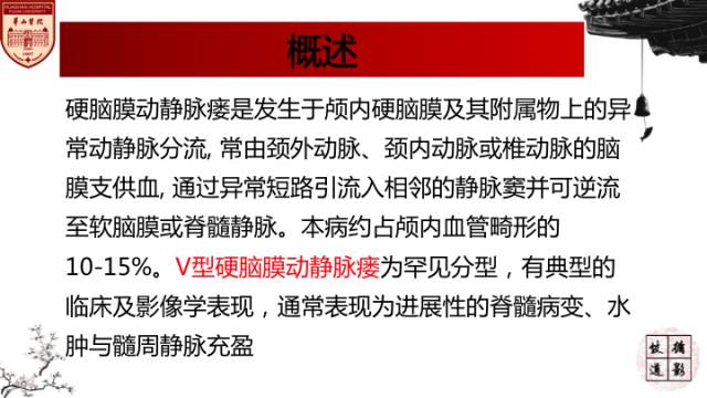 【病例】硬脑膜动静脉瘘1例MR影像表现分析 【病例】硬脑膜动静脉瘘1例MR影像表现分析
