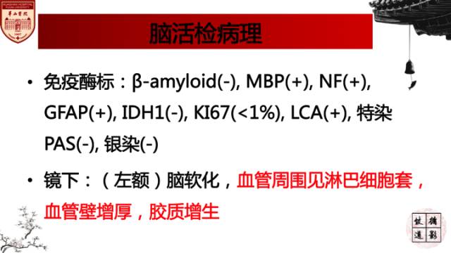 【病例】中枢神经系统血管炎1例MR影响表现 【病例】中枢神经系统血管炎1例MR影响表现