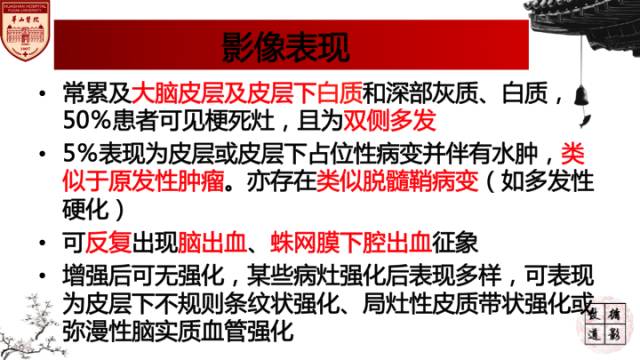 【病例】中枢神经系统血管炎1例MR影响表现 【病例】中枢神经系统血管炎1例MR影响表现