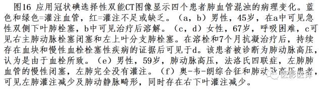 肺动脉高压的双能CT影像:挑战与机遇 肺动脉高压的双能CT影像:挑战与机遇