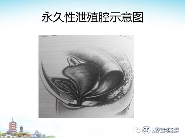 【PPT】胎儿腹部常见囊性病变的MRI诊断及鉴别
