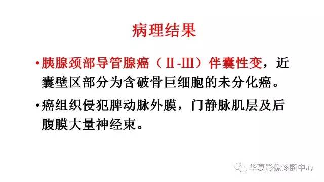 【病例】胰腺癌伴囊变坏死1例CT影像表现