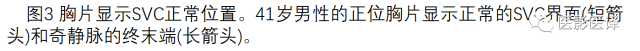 上腔静脉全面影像学回顾 上腔静脉全面影像学回顾