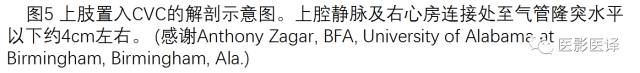 上腔静脉全面影像学回顾 上腔静脉全面影像学回顾