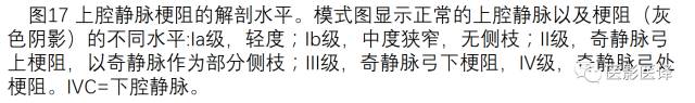 上腔静脉全面影像学回顾 上腔静脉全面影像学回顾