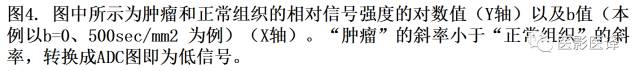 DWI原理及应用:癌症检测、分级和治疗随访 DWI原理及应用:癌症检测、分级和治疗随访