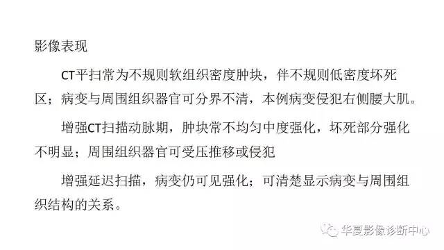 【病例】腹膜后恶性纤维组织细胞瘤1例CT影像表现