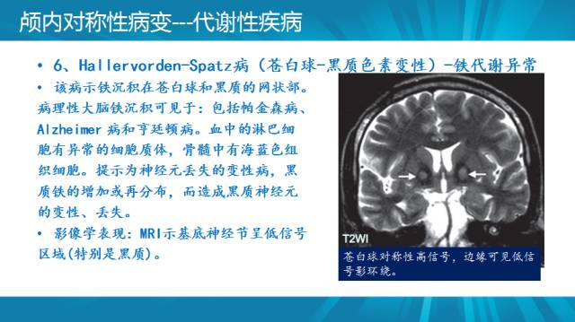 【PPT】颅内对称性病变汇总