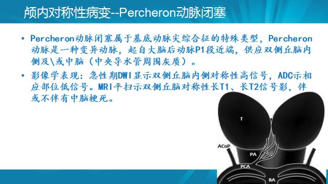 【PPT】颅内对称性病变汇总