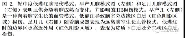 新生儿缺氧缺血性脑病多模态影像学表现 新生儿缺氧缺血性脑病多模态影像学表现
