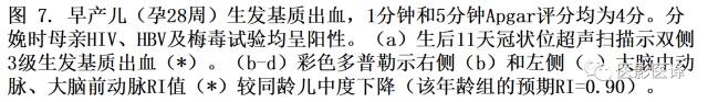 新生儿缺氧缺血性脑病多模态影像学表现 新生儿缺氧缺血性脑病多模态影像学表现