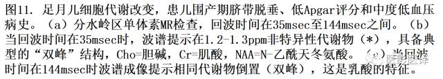 新生儿缺氧缺血性脑病多模态影像学表现 新生儿缺氧缺血性脑病多模态影像学表现