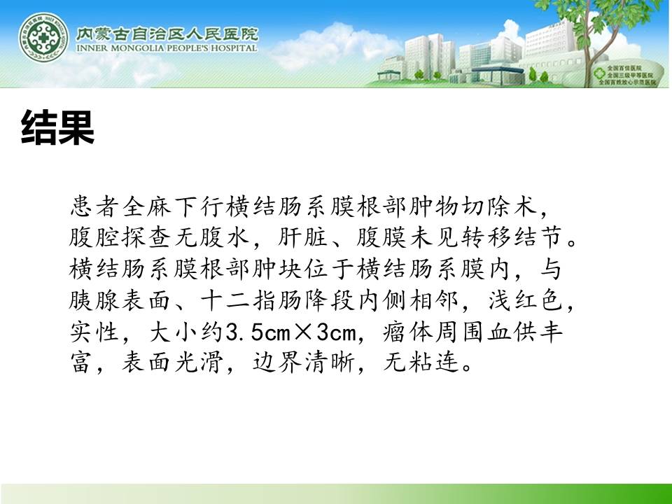 【病例】腹腔副神经节瘤1例CT