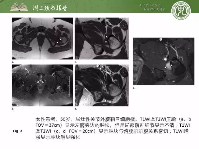【PPT】骨骼肌肉系统肿块影像学成像基本概念