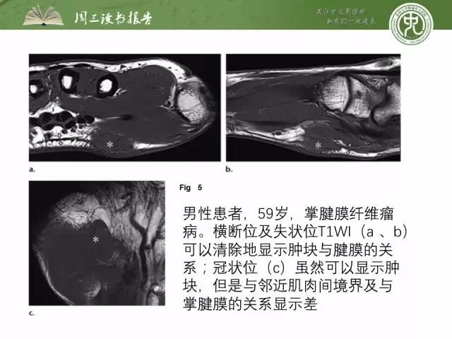 【PPT】骨骼肌肉系统肿块影像学成像基本概念