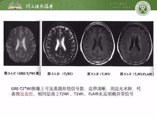 【PPT】骨骼肌肉系统肿块影像学成像基本概念