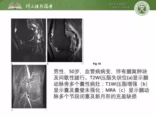 【PPT】骨骼肌肉系统肿块影像学成像基本概念