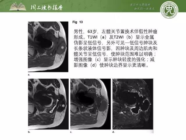 【PPT】骨骼肌肉系统肿块影像学成像基本概念