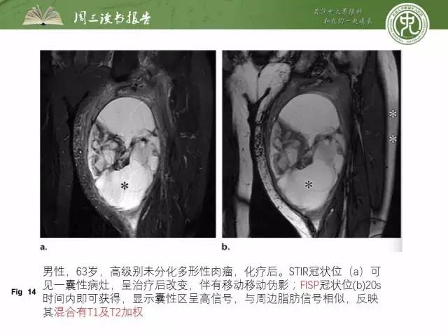 【PPT】骨骼肌肉系统肿块影像学成像基本概念
