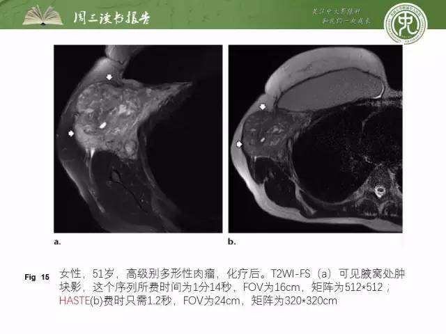 【PPT】骨骼肌肉系统肿块影像学成像基本概念