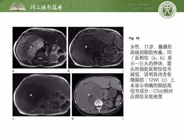 【PPT】骨骼肌肉系统肿块影像学成像基本概念
