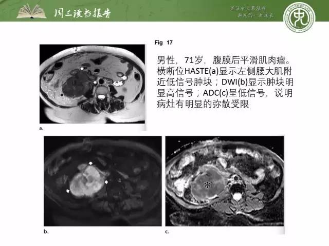 【PPT】骨骼肌肉系统肿块影像学成像基本概念